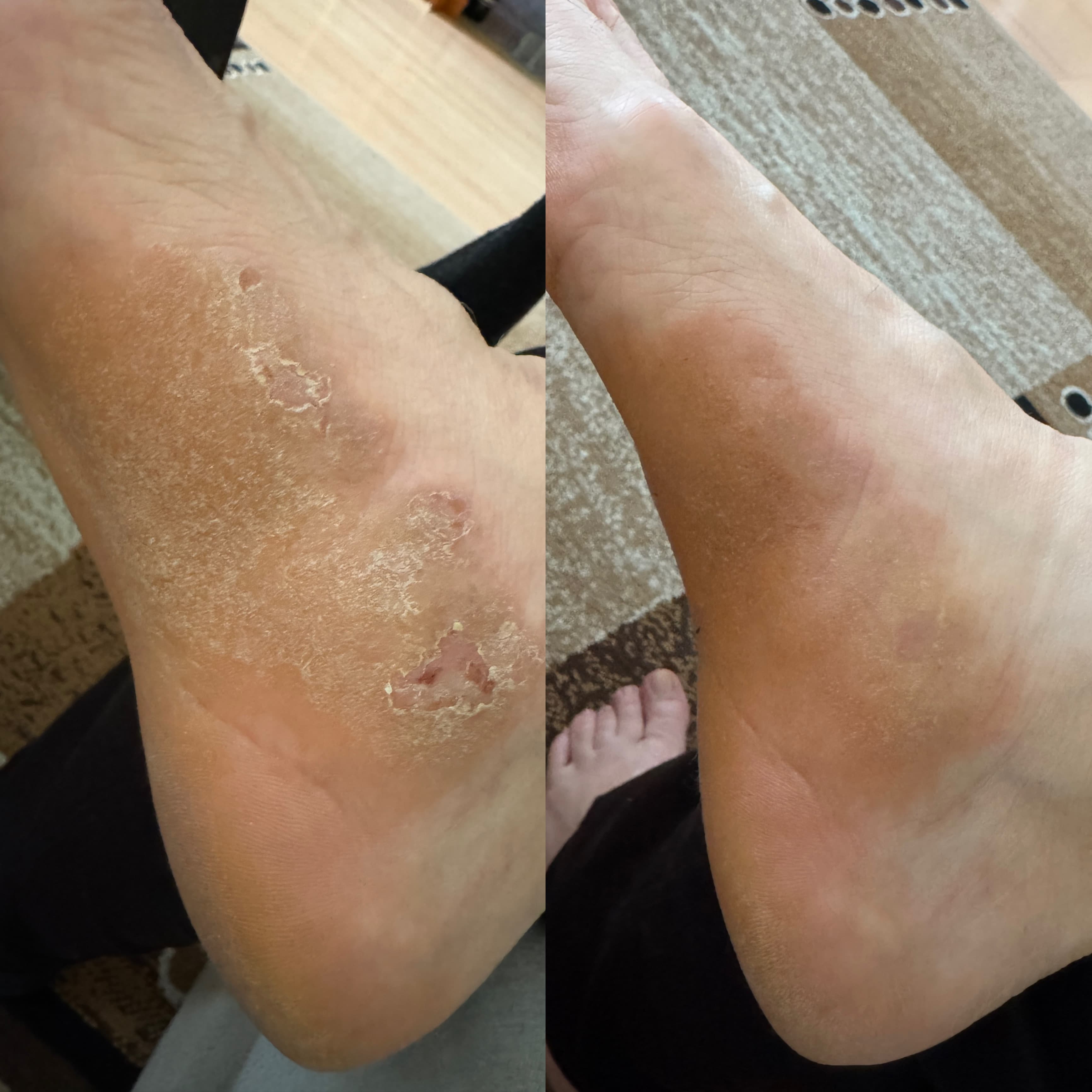Buy CBD Cream for sensitive skin